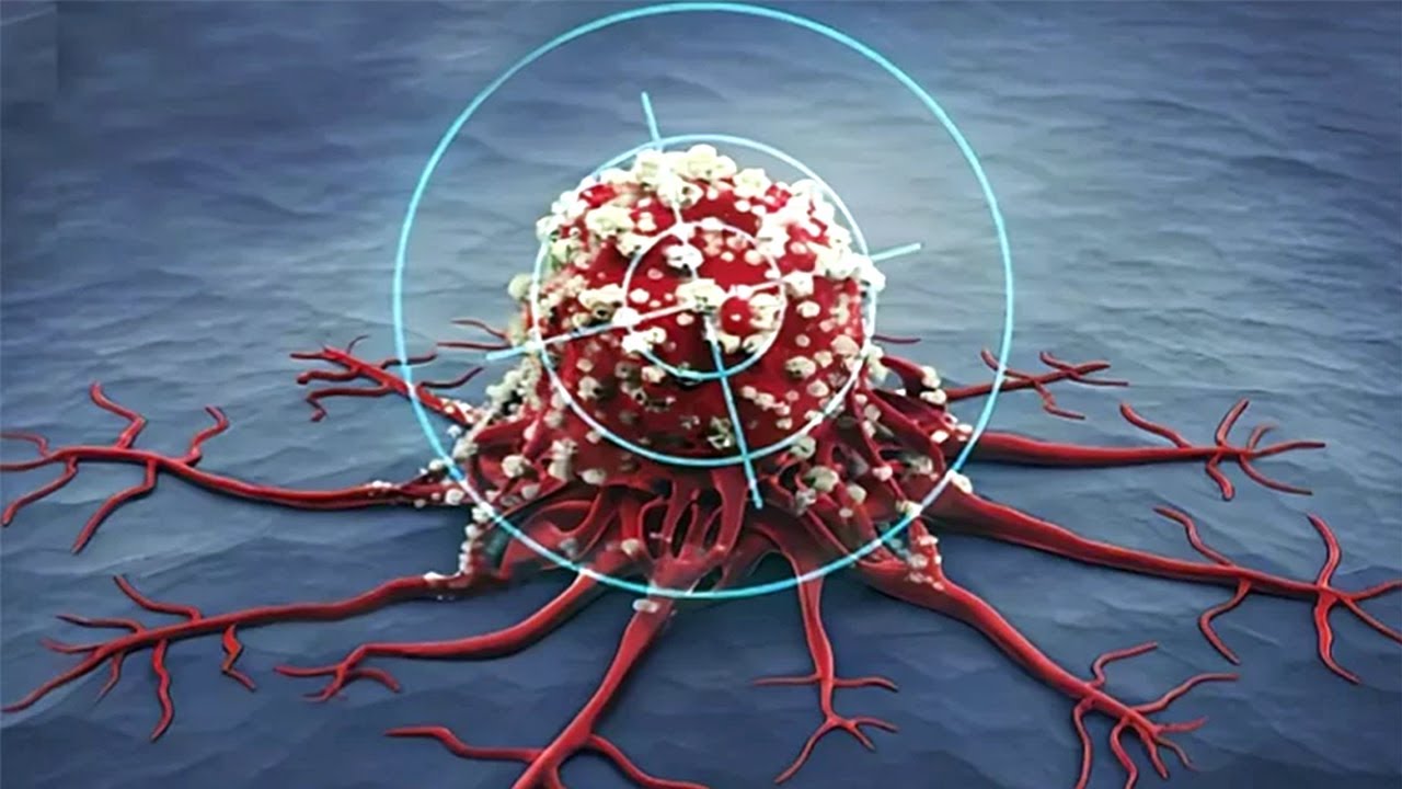 Bilim Dünyasından müjdeli haber: Kanser hücrelerine son veren yeni keşif!